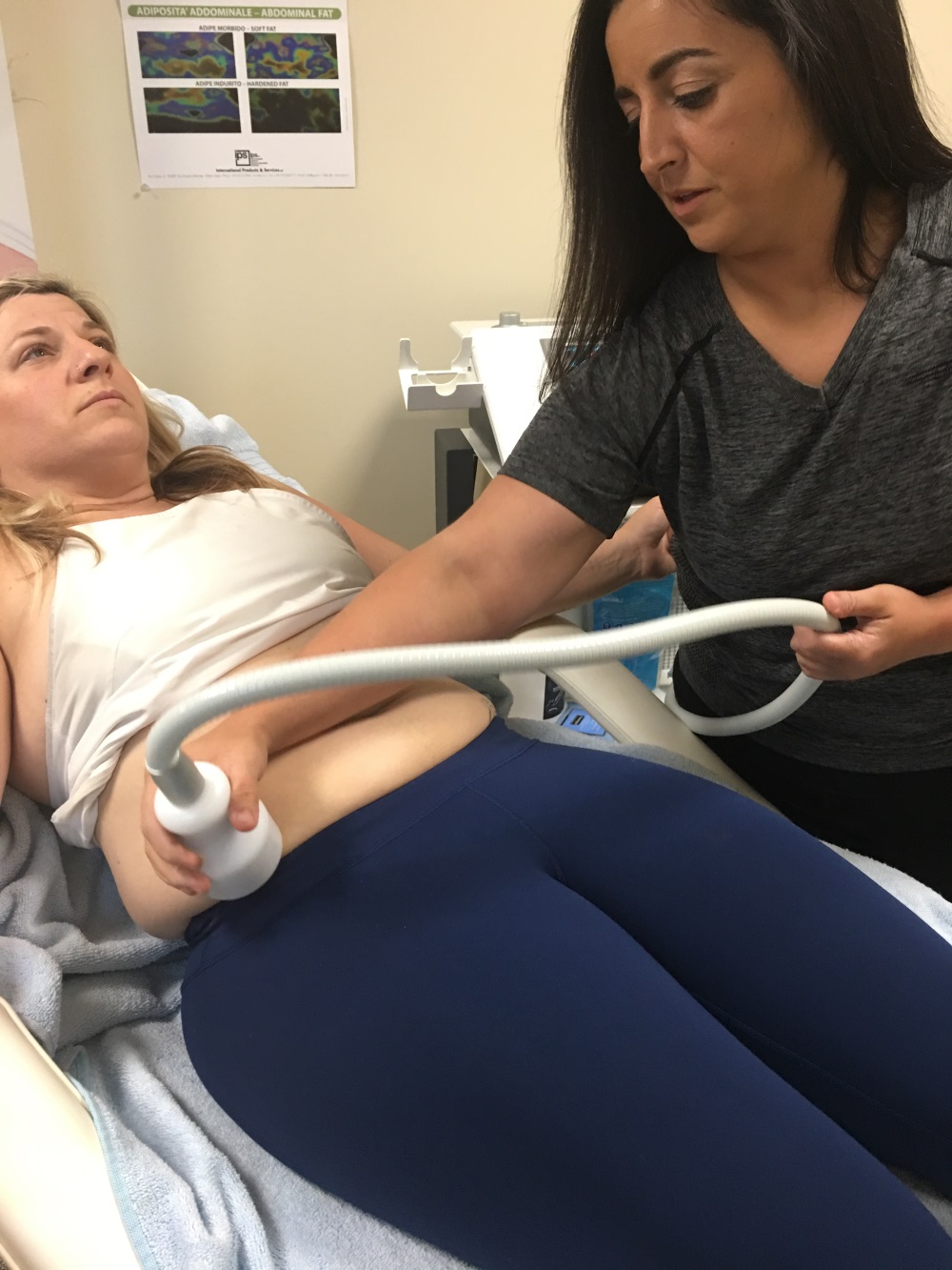 Fat Freezing
